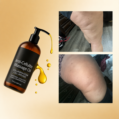 Aceite Anticelulitis Reafirmante